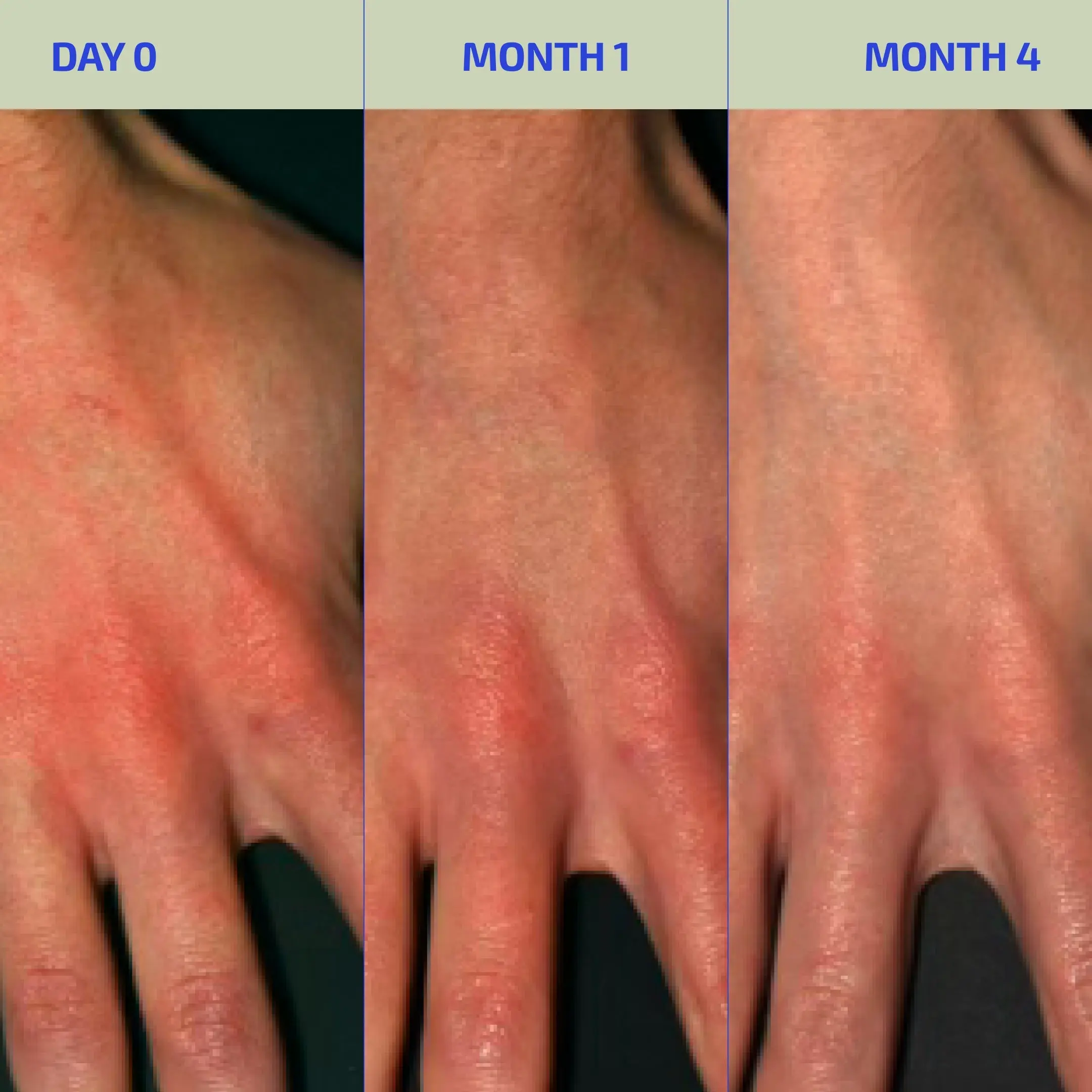 Codex Labs: BIA Eczema Relief Lotion - Image 4