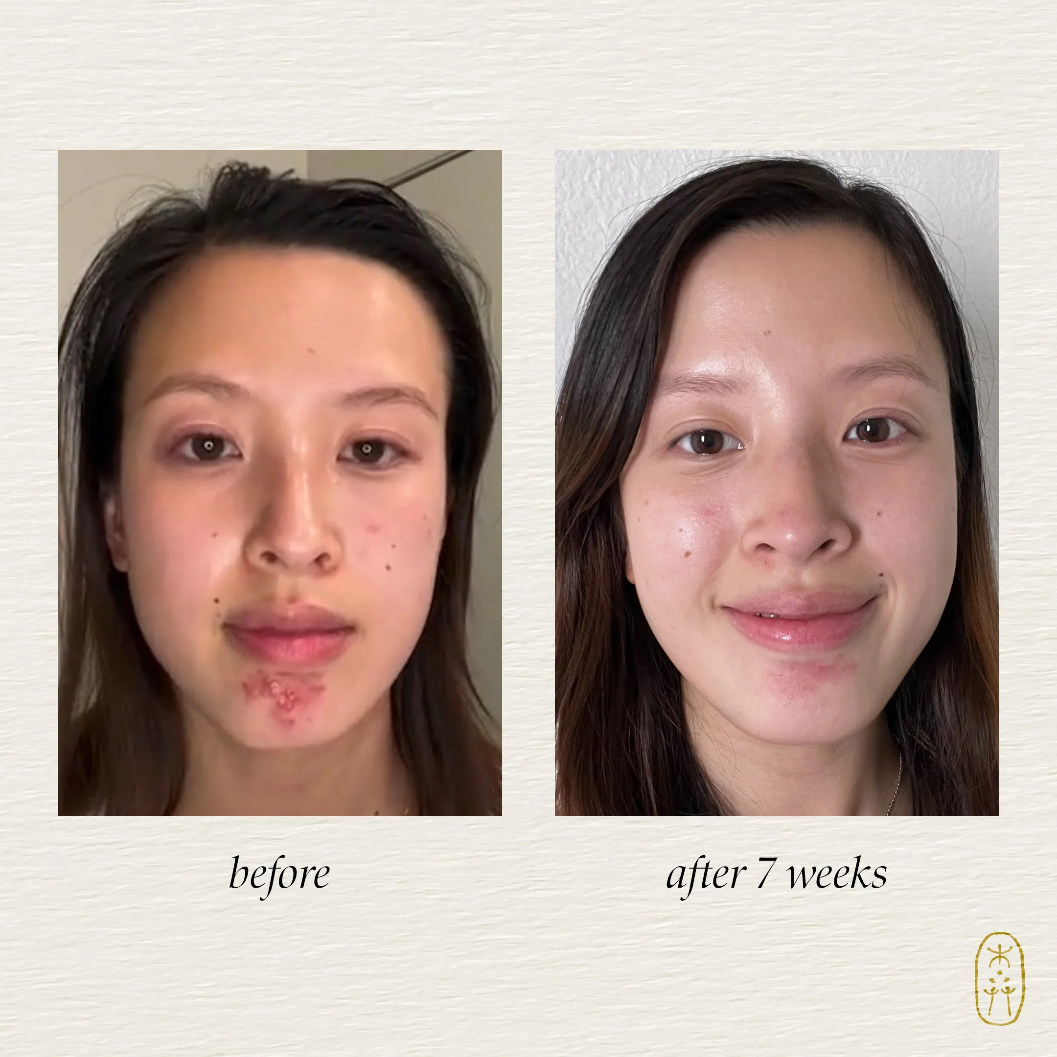 Clarify Botanical Serum - Image 3