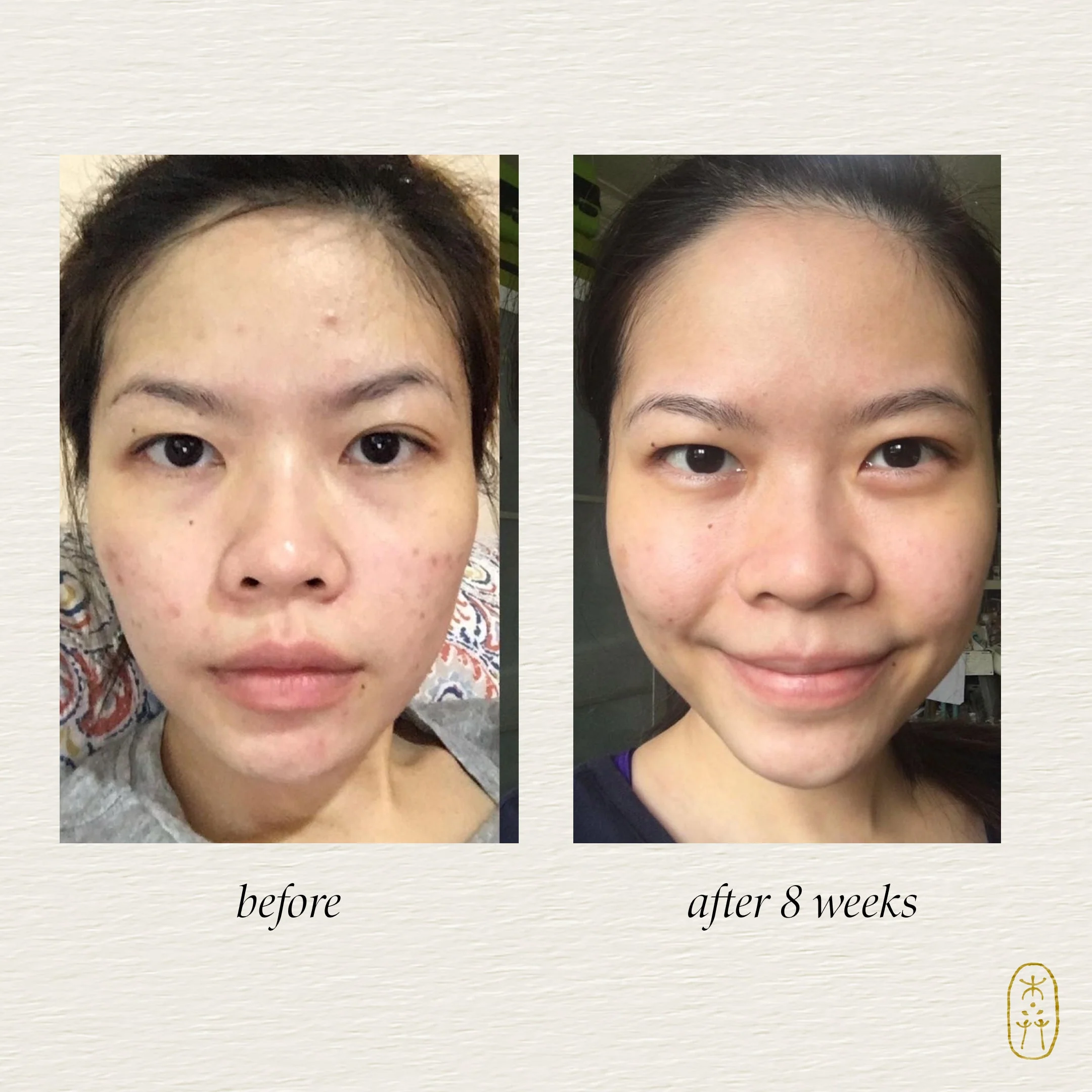 Clarify Botanical Serum - Image 4